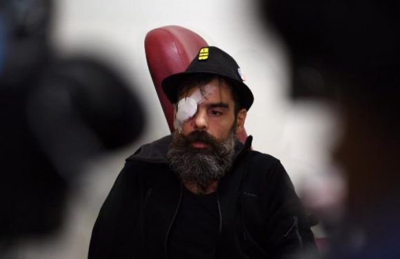 La blessure du gilet jaune Jérôme Rodrigues embarasse le gouvernement