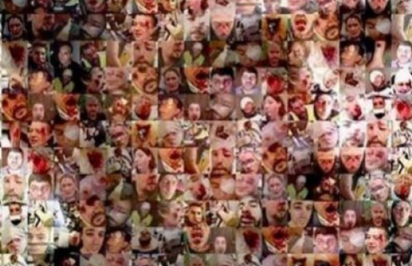 Paris : Gilets jaunes, un acte XII lancé pour les blessés, annoncés en tête de cortège