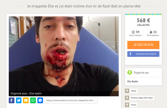 Les «gueules cassées» des réseaux, martyr des gilets jaunes