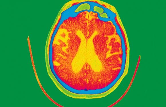 Blood test could detect Alzheimer’s up to 16 years before symptoms begin, study says