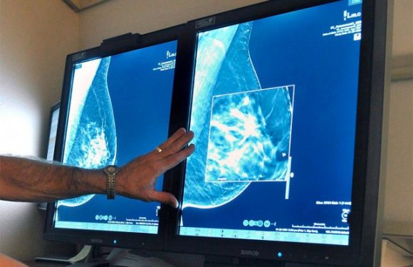 Un test de salive pour prédire les risques de cancer du sein