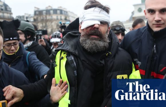 French police tactics under scrutiny after gilets jaunes injuries
