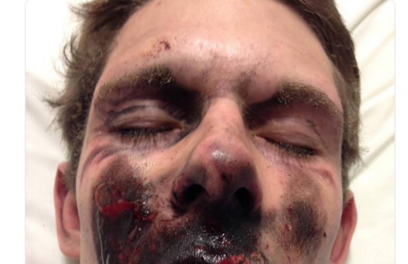 Non, cette photographie n’est pas celle d’un « gilet jaune » blessé le 19 janvier