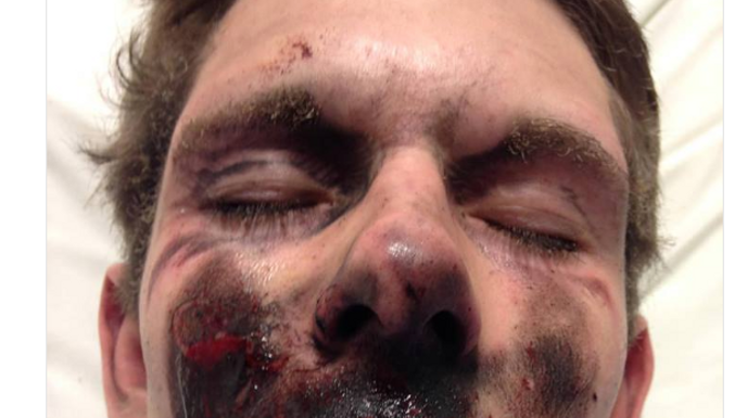 Non, cette photographie n’est pas celle d’un « gilet jaune » blessé le 19 janvier