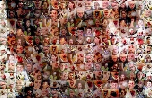 Gilets jaunes. Acte 12 samedi 2 février avec les victimes en tête de cortège