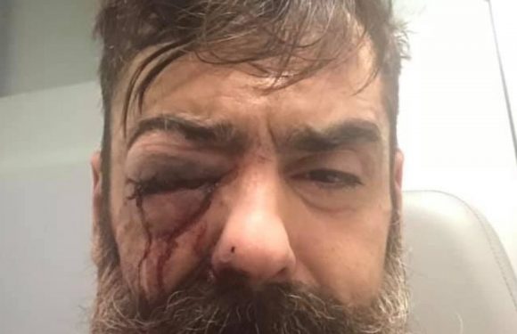 Xavier Lemoine : «La police a moins réprimé les émeutes en banlieue en 2005 que les ‘gilets jaunes‘»