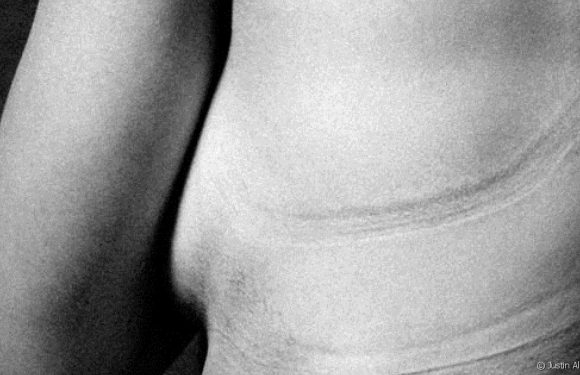 Il photographie les marques laissées par les vêtements pour dénoncer les diktats