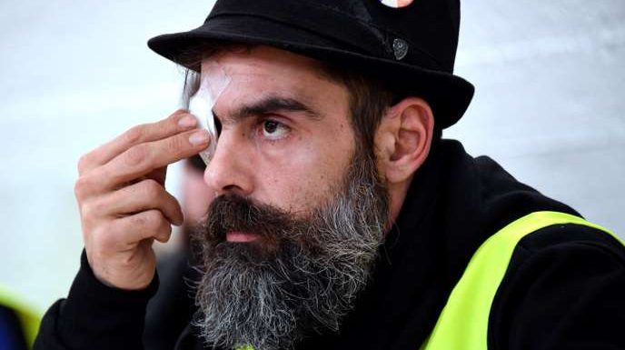 Blessure du « gilet jaune » Jérôme Rodrigues : l’hypothèse d’un tir de LBD relancée