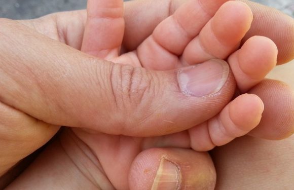 Bébés nés sans bras : trois nouveaux cas dans les Bouches-du-Rhône