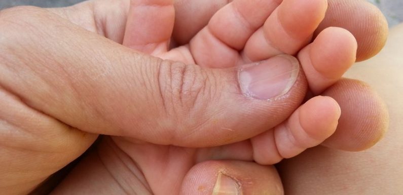 Bébés nés sans bras : trois nouveaux cas dans les Bouches-du-Rhône