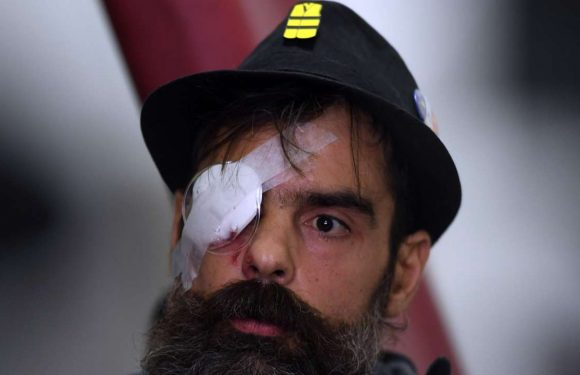 Blessure du « gilet jaune » Jérôme Rodriguez : l’exécutif tente d’éteindre l’incendie