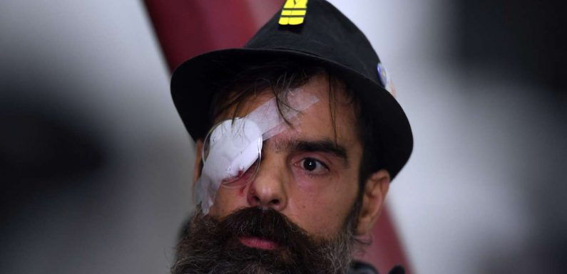 Blessure du « gilet jaune » Jérôme Rodriguez : l’exécutif tente d’éteindre l’incendie