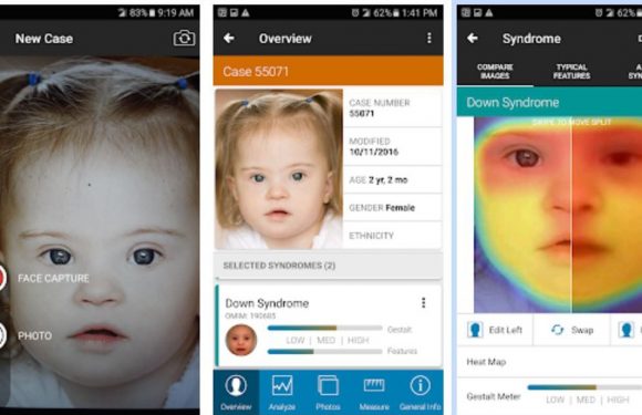 Maladies génétiques: Une appli de reconnaissance faciale pour améliorer le diagnostic
