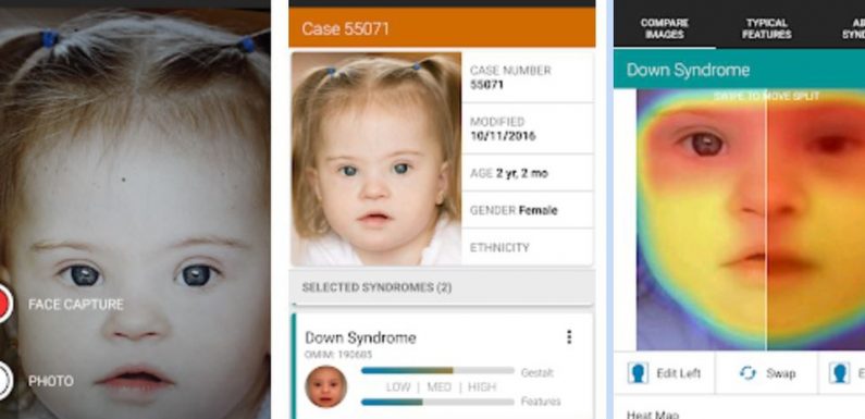 Maladies génétiques: Une appli de reconnaissance faciale pour améliorer le diagnostic