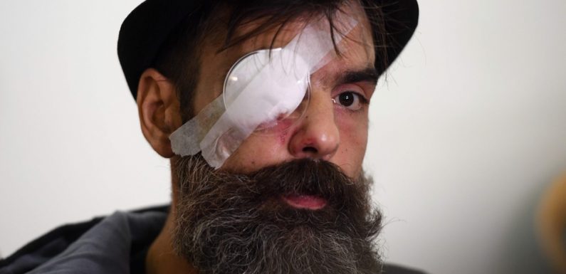 Blessure de Jérôme Rodrigues: Une vidéo relance l’hypothèse d’un tir de LBD lors du rassemblement de «gilets jaunes»