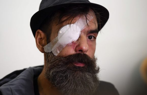 Blessure de Jérôme Rodrigues : Une vidéo relance l’hypothèse d’un tir de LBD lors du rassemblement de « gilets jaunes »