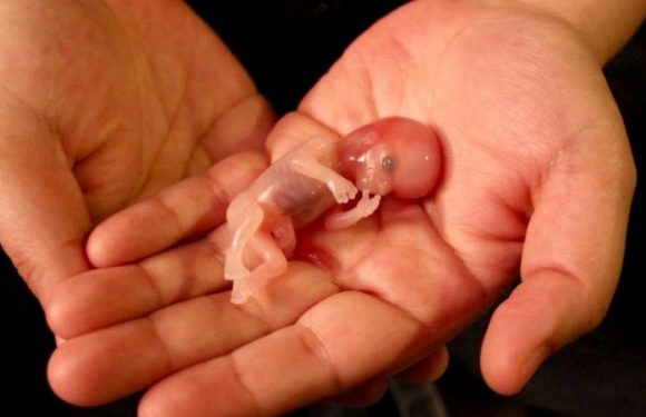 Nouvelle loi pour interdire les avortements tardifs