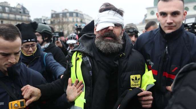 Acte XI des « gilets jaunes » : un proche d’Eric Drouet blessé à l’œil, l’IGPN saisie