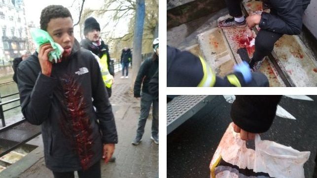 Strasbourg : un adolescent de 15 ans blessé au visage en marge de la manifestation des gilets jaunes