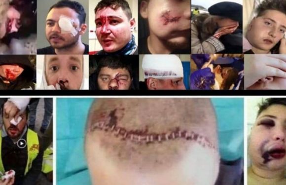 Violences policières : cela commence à sortir