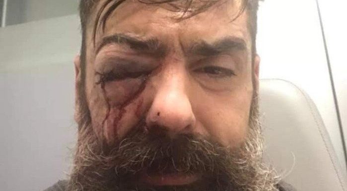 #ActeXI : Jérôme Rodrigues, une figure des Gilets Jaunes, proche d’Éric Drouet, « va perdre un oeil » suite à un jet de grenade (MàJ : l’IGPN saisie)