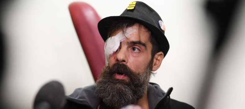The French police’s brutality against the gilets jaunes can no longer be denied