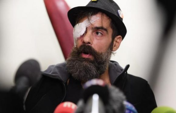 Le gilet jaune Jérôme Rodrigues aurait été blessé par une grenade, peut-être mal utilisée