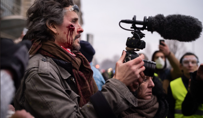 Le réalisateur Florent Marcie blessé par un tir de flashball