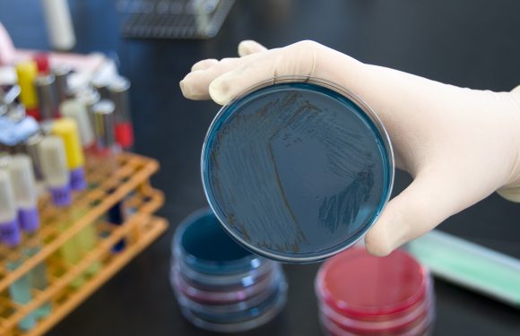 La salmonelle est impliquée dans beaucoup de scandales sanitaires — voici ce qu’il faut savoir sur cette bactérie