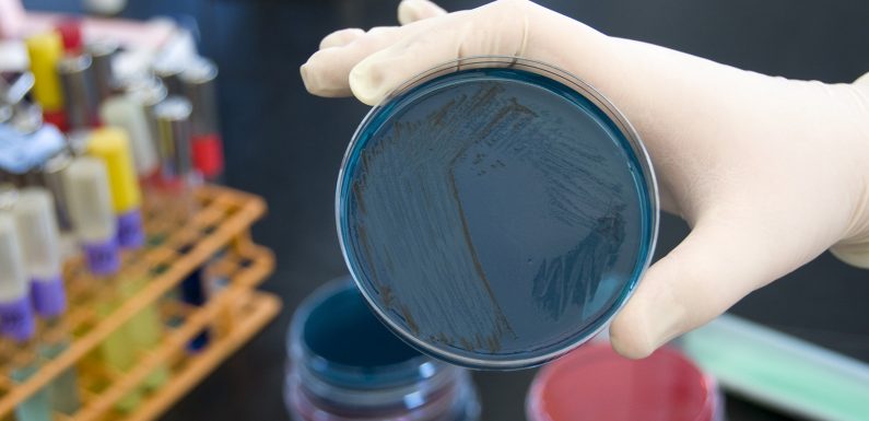La salmonelle est impliquée dans beaucoup de scandales sanitaires — voici ce qu’il faut savoir sur cette bactérie