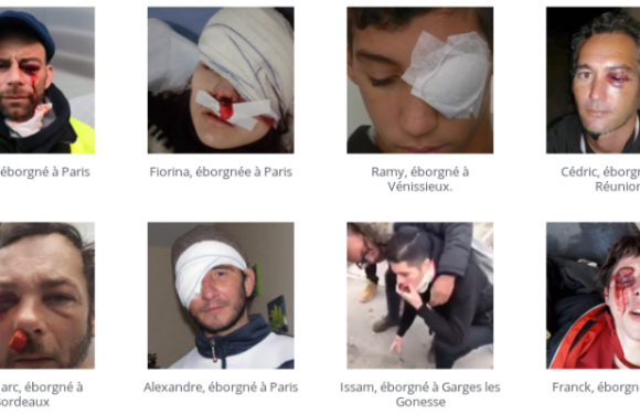 Europe : le Parlement condamne l’usage des lanceurs de balles de défense par la police