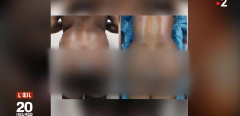 VIDEO. Nue sur internet, merci docteur !