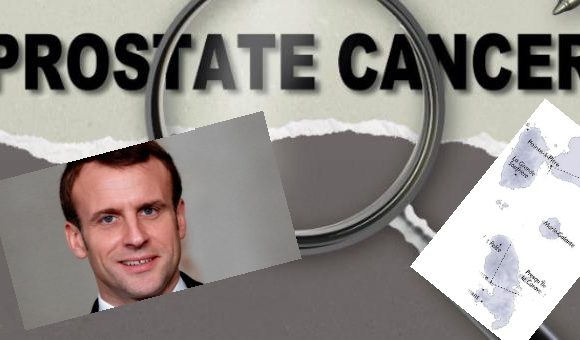 Oui Mr le Président, le chlordécone est bien cancérogène