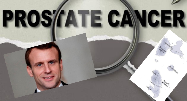 Oui Mr le Président, le chlordécone est bien cancérogène