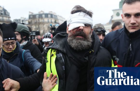 Gilets jaunes leader hit in eye during protest ‘will be disabled for life’