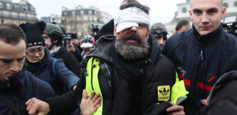 «Gilets jaunes»: L’enquête sur la blessure à l’œil de Jérôme Rodrigues confiée à des juges d’instruction