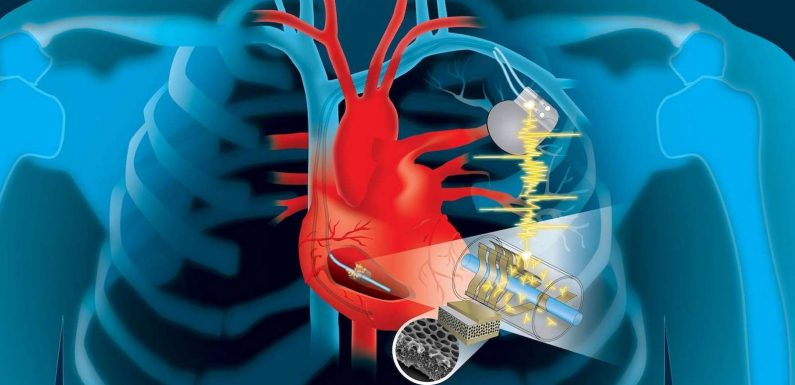 Les pacemakers bientôt rechargés par les battements du cœur ?