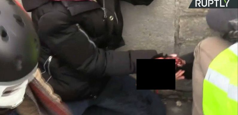 Acte XIII des Gilets Jaunes : Un manifestant a la main arrachée par une grenade GLIF4 (Vidéo choquante)