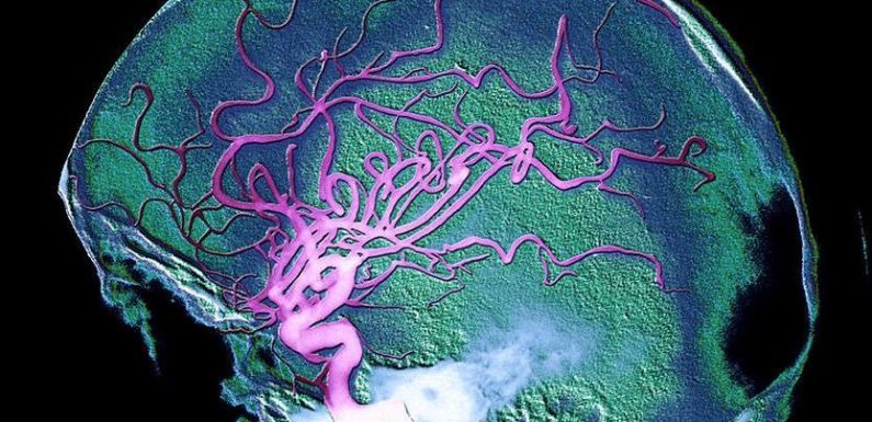 Une importante découverte réalisée à Toulouse pourrait permettre de ralentir la maladie d’Alzheimer