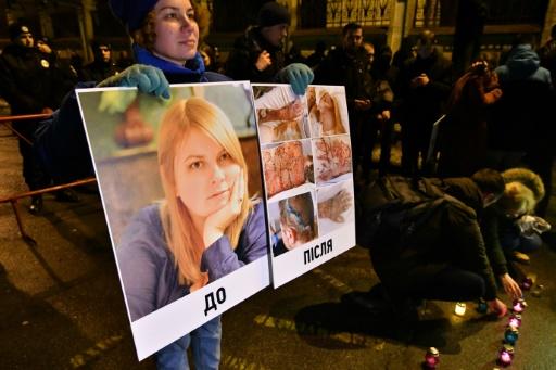 Ukraine: un élu poursuivi pour l’attaque à l’acide d’une militante