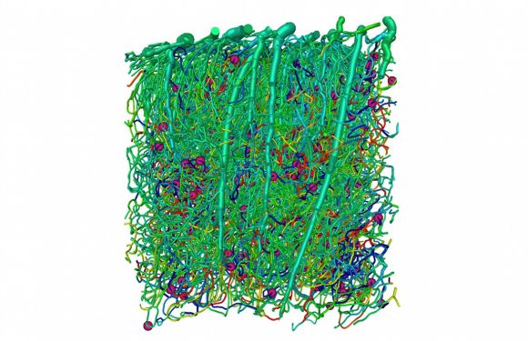 Alzheimer : la piste du débit sanguin