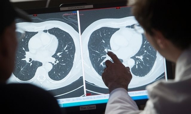 Cancer du col de l’utérus Vaccination et dépistage pour en venir à bout