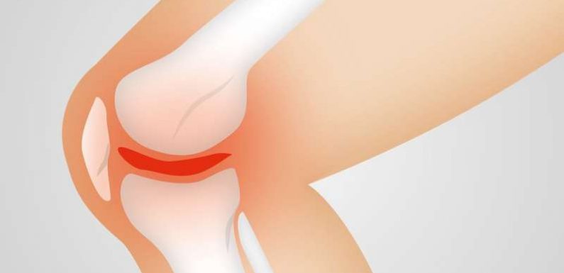 Bientôt un nouveau traitement contre l’arthrose ?