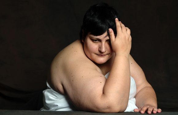 Pour que les personnes obèses ne soient plus invisibles, des portraits au naturel