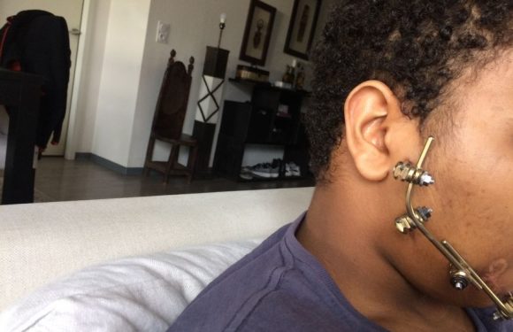 Strasbourg : l&rsquo;adolescent blessé au visage par un tir de LBD est toujours immobilisé chez lui