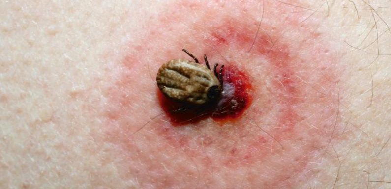 Après une piqûre de tique, les signes qui doivent alerter sur la Maladie de Lyme