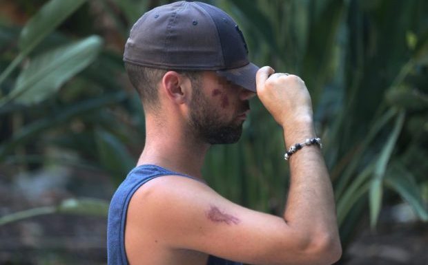 Nice : ils le traitent de « sale pédé » et le violent à trois