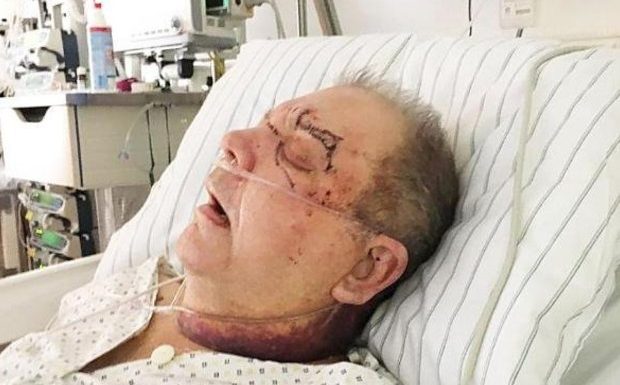 Allemagne : Detlef, 75 ans, sauvagement tabassé par Ali, un Somalien de 25 ans, est aveugle de l’œil gauche et ne peut plus se nourrir seul