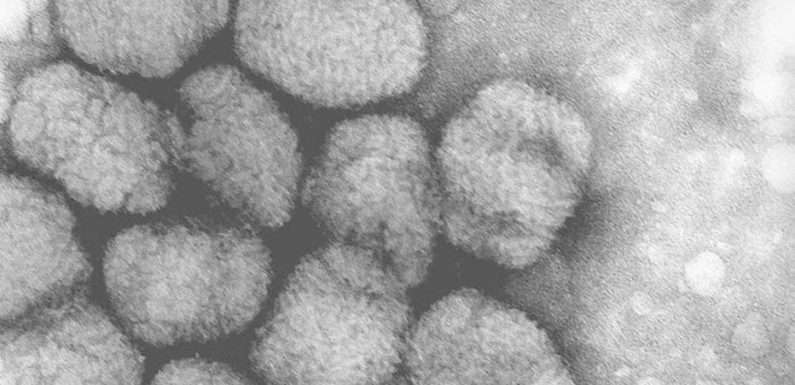 Russie : explosion dans un laboratoire renfermant la variole et Ebola