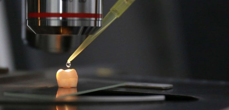 Caries : une nouvelle technique pour réparer l’émail de nos dents